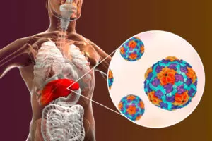 Hepatites virais - infectologista em Higienópolis